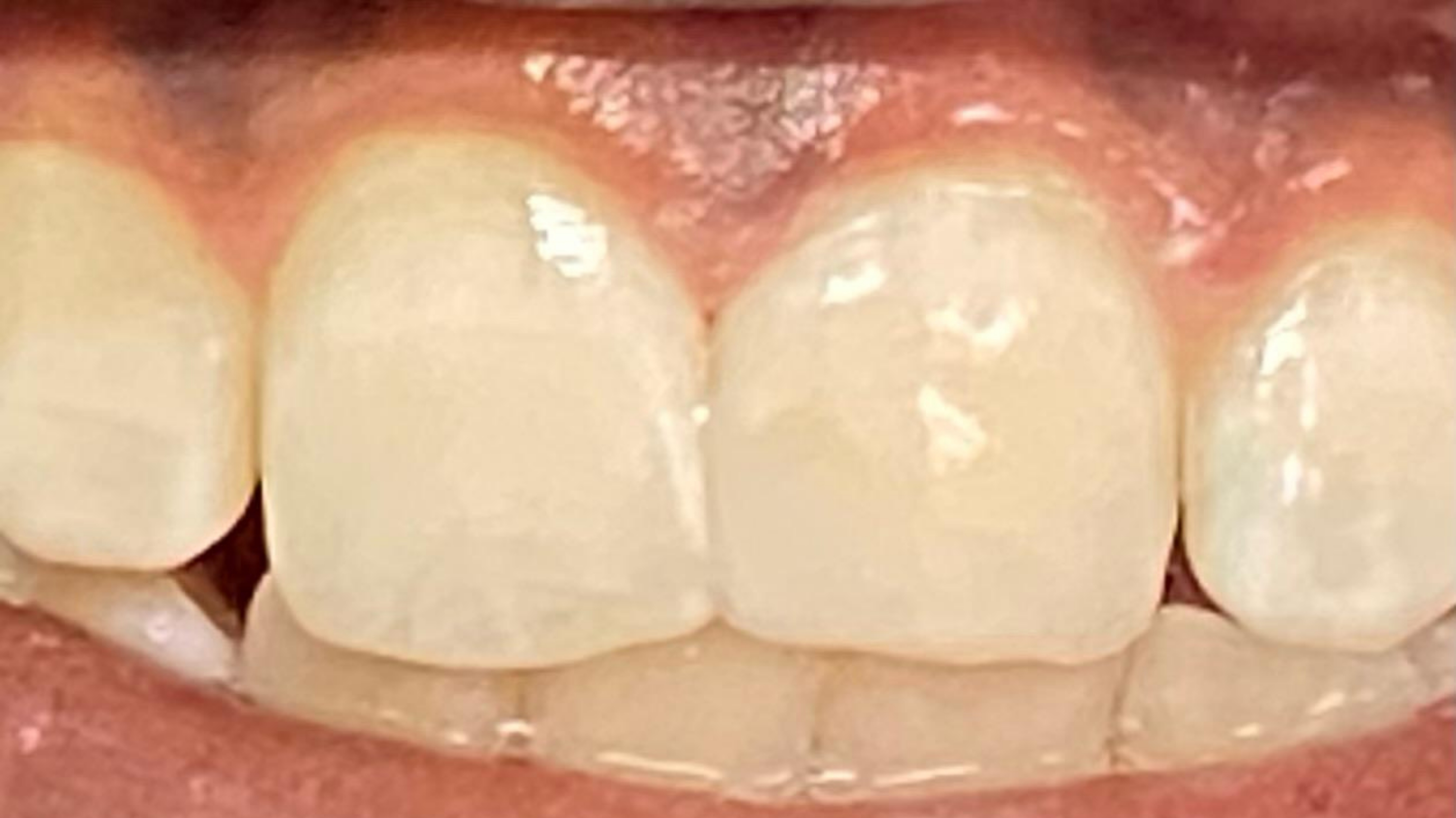 Before and After 8